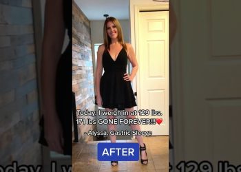 171 lbs Gone Forever!! | My Weight Loss Surgery Journey