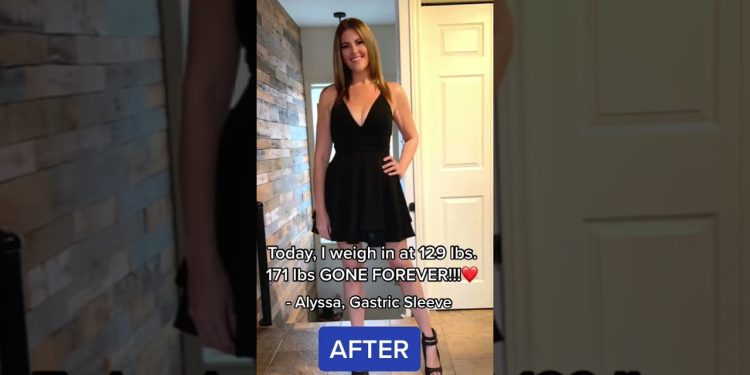 171 lbs Gone Forever!! | My Weight Loss Surgery Journey