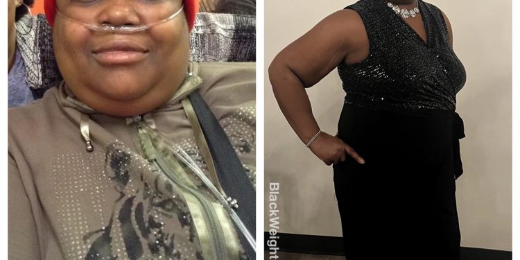 Angela lost 93 pounds – Black Weight Loss Success
