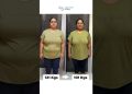 20 kgs Weight Loss | My CALORIE DEFICIT DIET PLAN