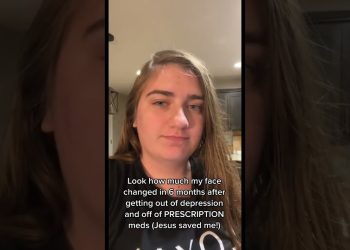 HOW 50 POUNDS WEIGHT LOSS CHANGES YOUR FACE!!