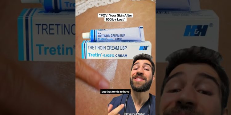 Stretchmarks After Weight Loss? Doctor Explains